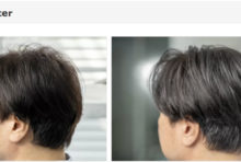 薄毛、臭い、抜け毛予防に特化した「頭皮環境改善コース」がお得!!　クーズヘア