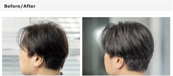 薄毛、臭い、抜け毛予防に特化した「頭皮環境改善コース」がお得!!　クーズヘア - ワイズデジタル【タイで生活する人のための情報サイト】